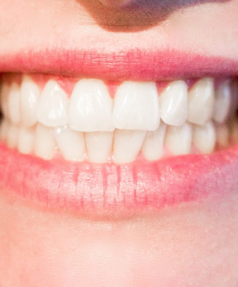 Nowoczesna technologia stosowana w salonach stomatologii estetycznej być może sprawić, że odzyskamy ładny uśmiech.